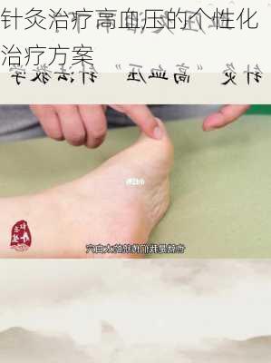 针灸治疗高血压的个性化治疗方案