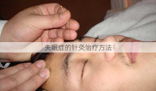 失眠症的针灸治疗方法