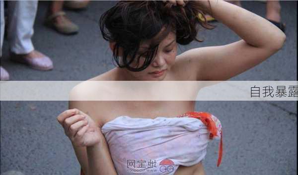 自我暴露