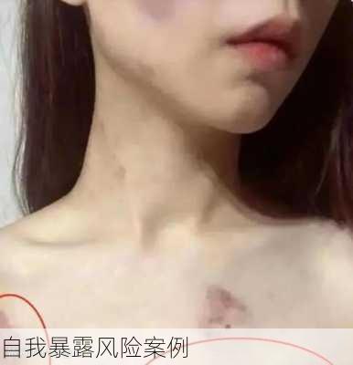 自我暴露风险案例