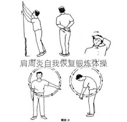 肩周炎自我恢复锻炼体操