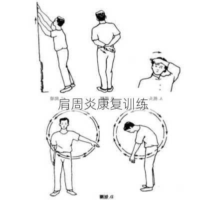 肩周炎康复训练