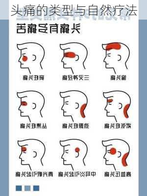 头痛的类型与自然疗法