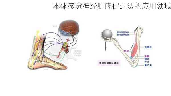本体感觉神经肌肉促进法的应用领域