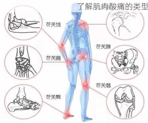 了解肌肉酸痛的类型
