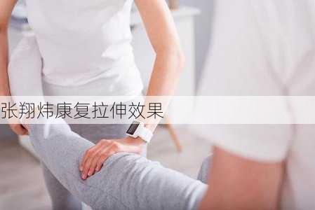张翔炜康复拉伸效果