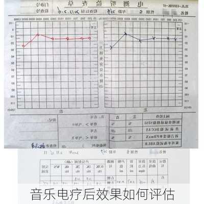 音乐电疗后效果如何评估