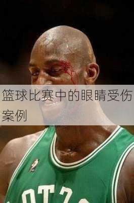 篮球比赛中的眼睛受伤案例