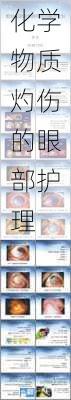 化学物质灼伤的眼部护理