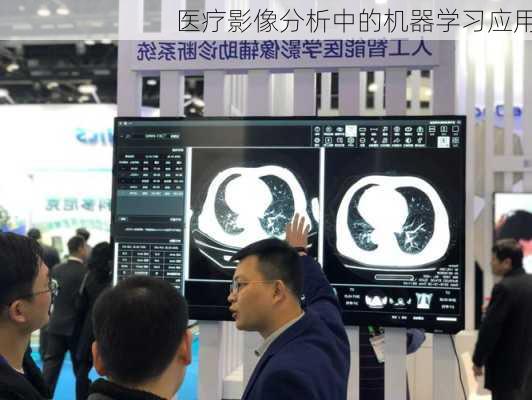 医疗影像分析中的机器学习应用