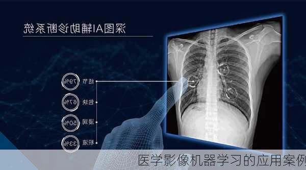 医学影像机器学习的应用案例