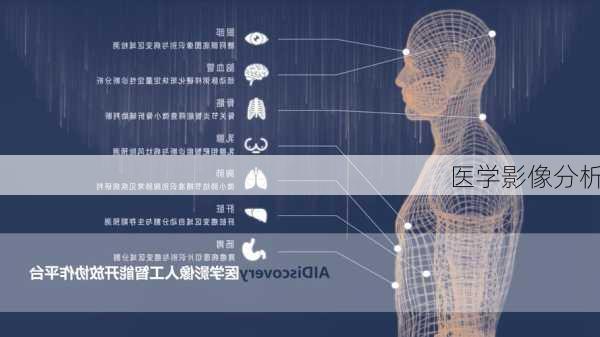 医学影像分析