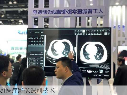 ai医疗影像识别技术