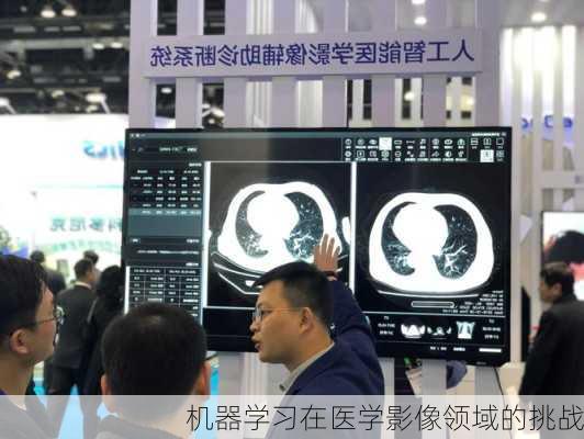 机器学习在医学影像领域的挑战