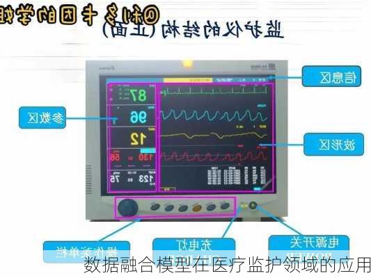 数据融合模型在医疗监护领域的应用