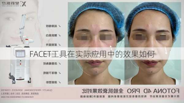 FACET工具在实际应用中的效果如何
