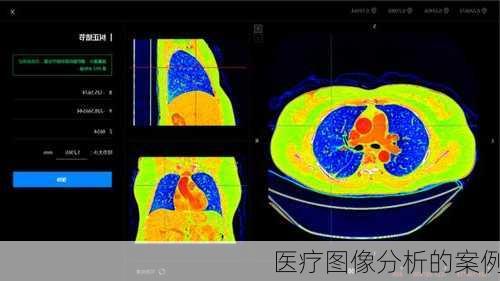 医疗图像分析的案例