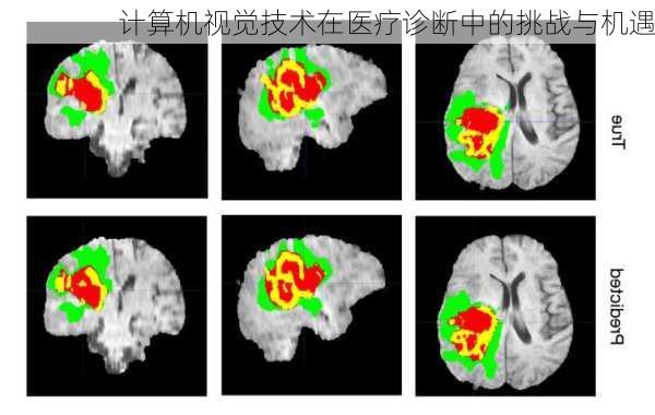 计算机视觉技术在医疗诊断中的挑战与机遇