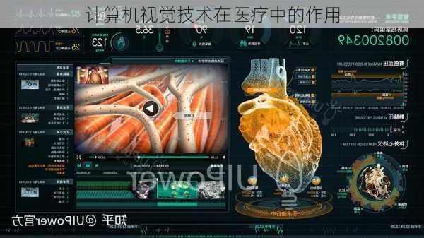 计算机视觉技术在医疗中的作用