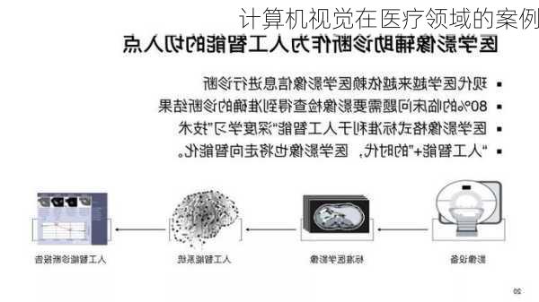 计算机视觉在医疗领域的案例