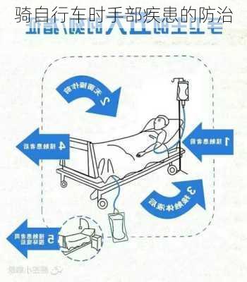 骑自行车时手部疾患的防治