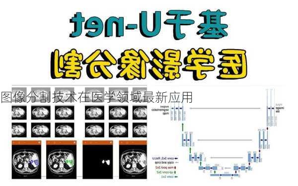 图像分割技术在医学领域最新应用