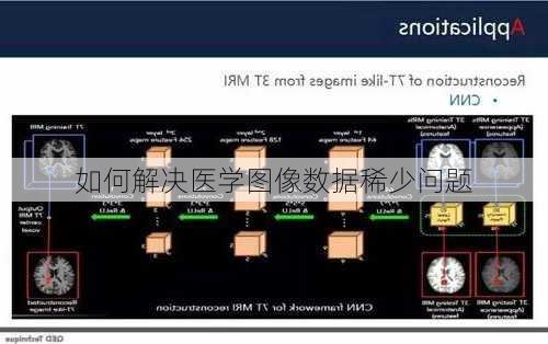 如何解决医学图像数据稀少问题