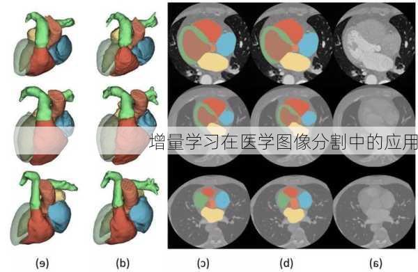 增量学习在医学图像分割中的应用