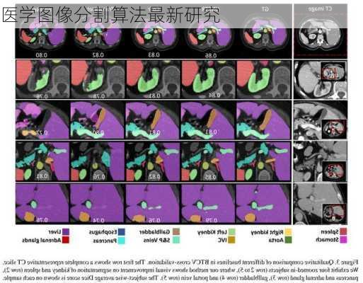 医学图像分割算法最新研究