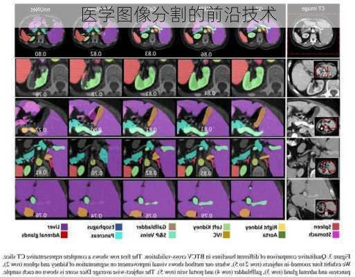 医学图像分割的前沿技术