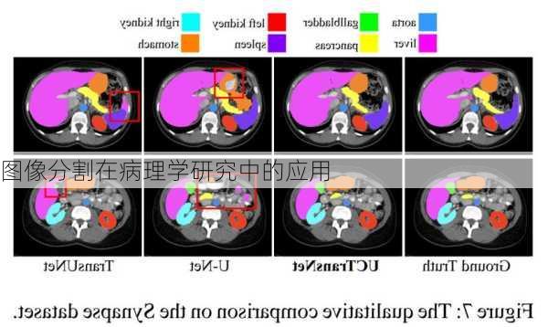 图像分割在病理学研究中的应用