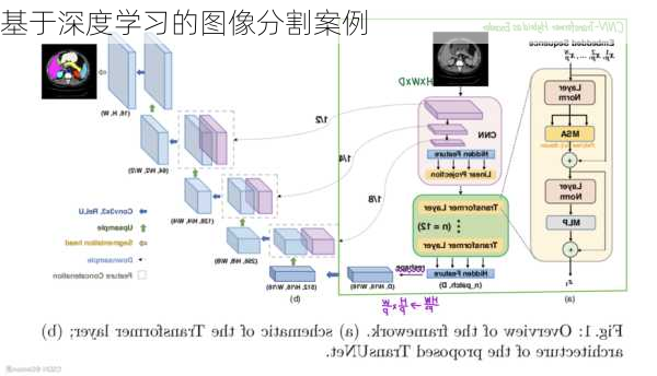 基于深度学习的图像分割案例
