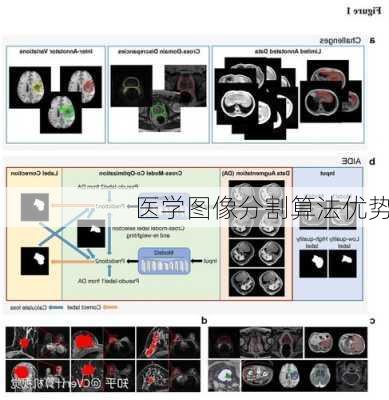 医学图像分割算法优势