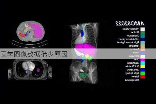 医学图像数据稀少原因