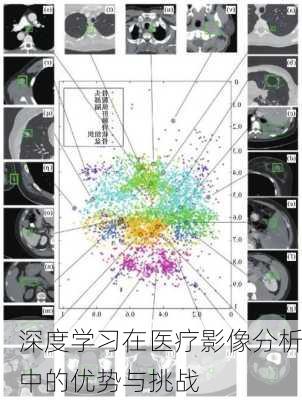 深度学习在医疗影像分析中的优势与挑战