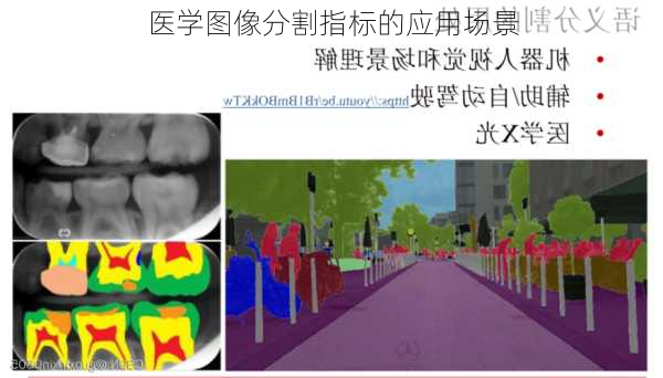 医学图像分割指标的应用场景