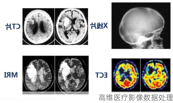 高维医疗影像数据处理