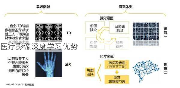 医疗影像深度学习优势
