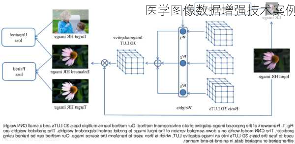 医学图像数据增强技术案例