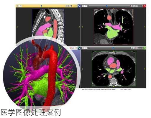 医学图像处理案例