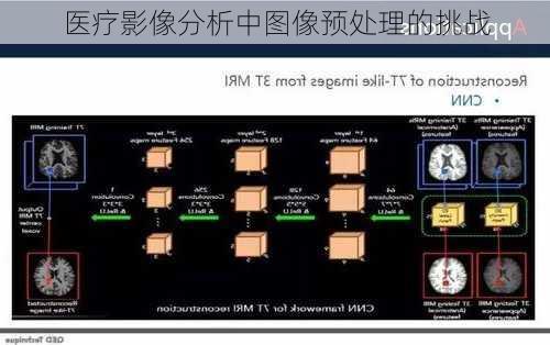 医疗影像分析中图像预处理的挑战