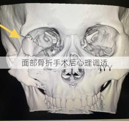 面部骨折手术后心理调适