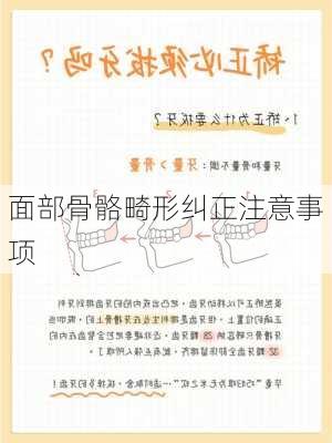 面部骨骼畸形纠正注意事项