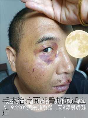 手术治疗面部骨折的适应症