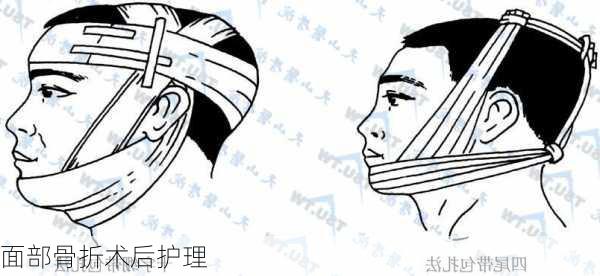面部骨折术后护理