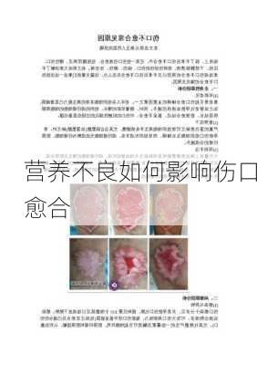 营养不良如何影响伤口愈合
