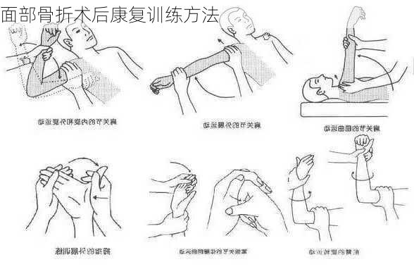 面部骨折术后康复训练方法