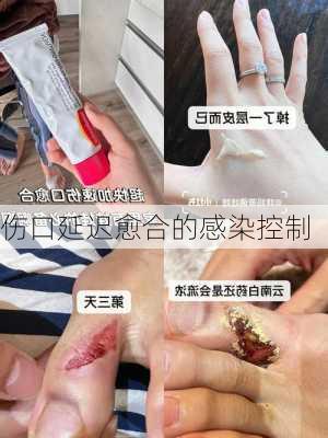 伤口延迟愈合的感染控制