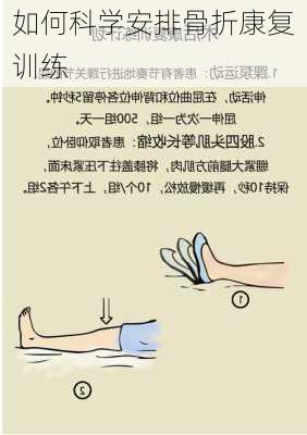 如何科学安排骨折康复训练