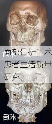 面部骨折手术患者生活质量研究